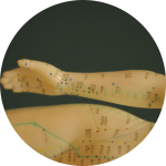 Acupuncture